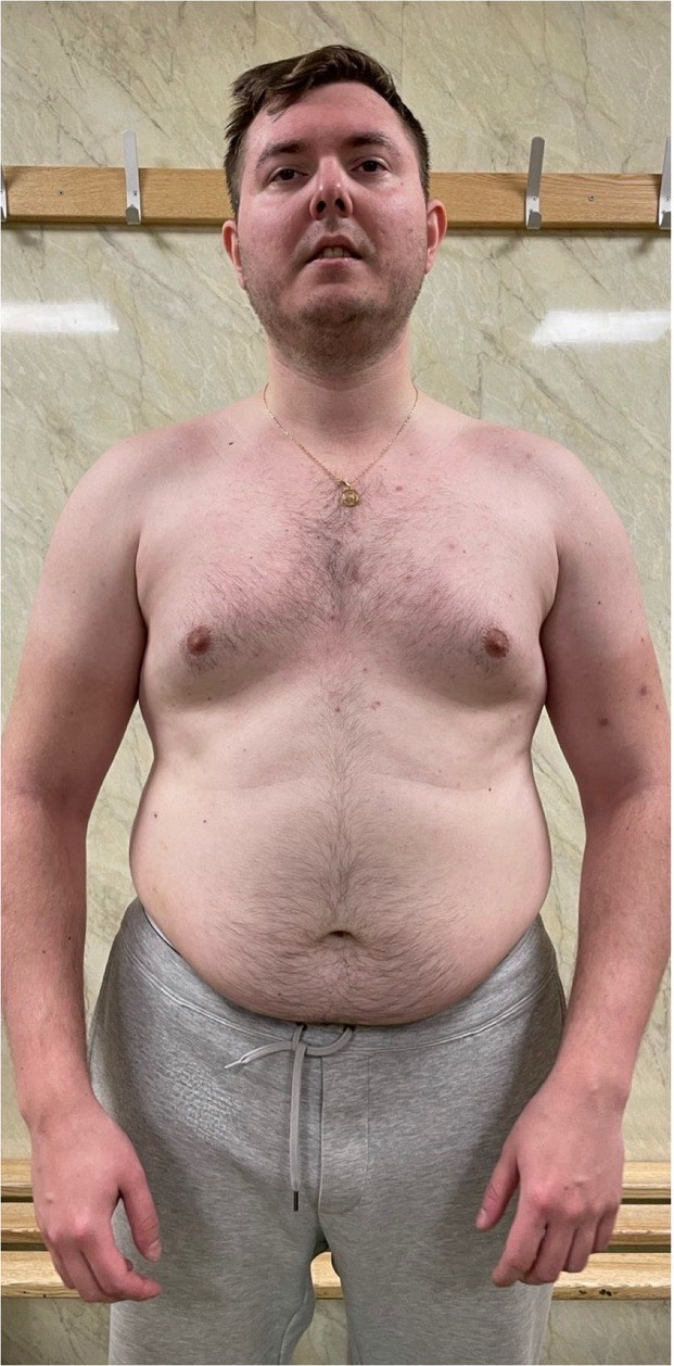 Anton: before and after transformation with Strategic Gains