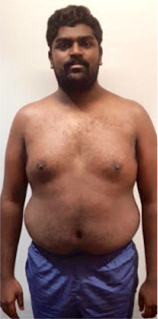 Bala: before and after transformation with Strategic Gains