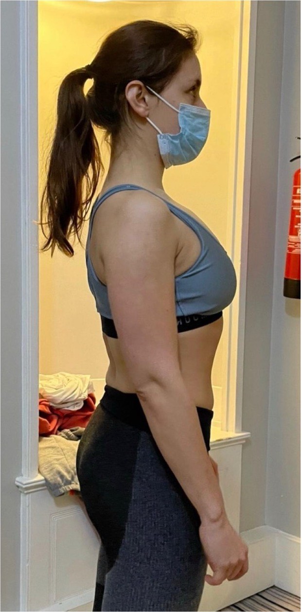 Sofia: before and after transformation with Strategic Gains
